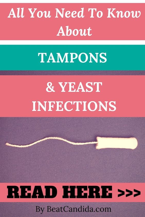 Do tampons cause a yeast infection?