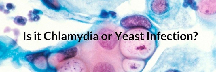 Vaginal Yeast Infection Symptoms Archives Lets Beat Yeast Infections