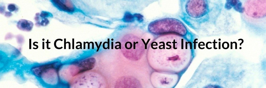 Is it Chlamydia or Yeast Infection?
