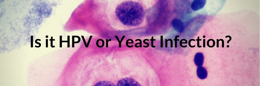 Is it HPV or Yeast Infection