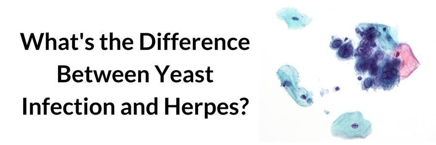 What's the Difference Between Yeast Infection and Herpes?